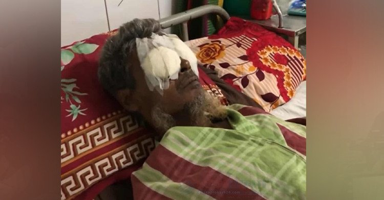 বাবার নির্দেশে ভাইয়ের চোখ উপড়ে নিল দুই ভাই, মুলাদীতে চাঞ্চল্য